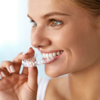 clear aligners